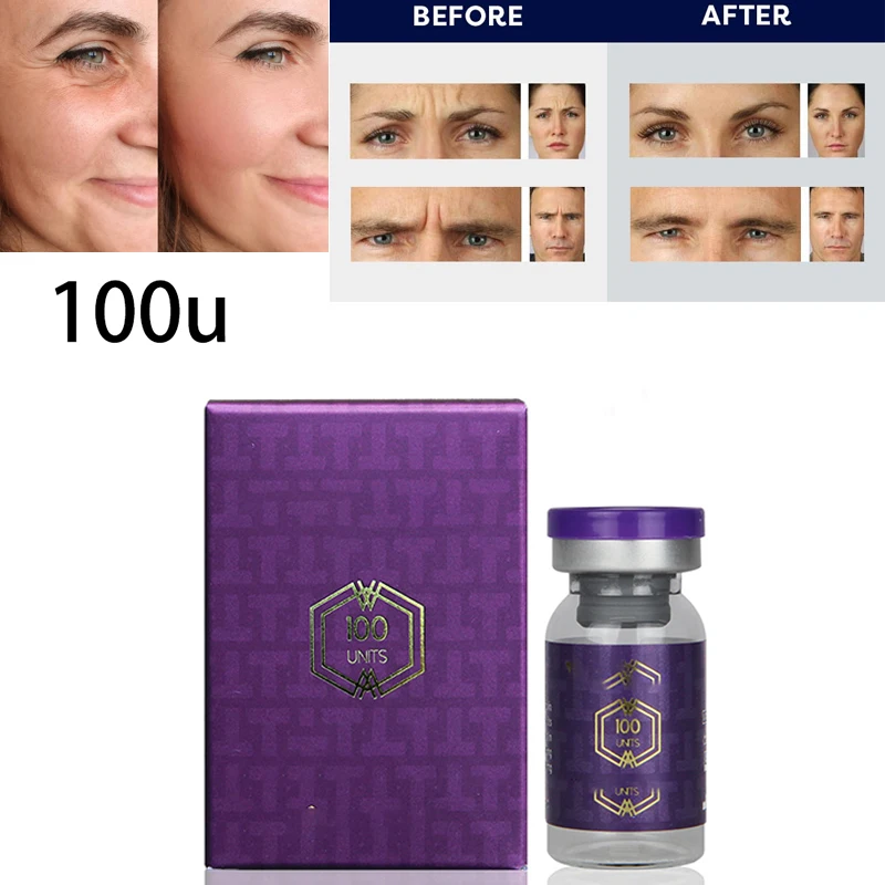 

Korean 100% Original 100u Anti-wrinkle Face Lifting Wrinkle Removal Anti-aging