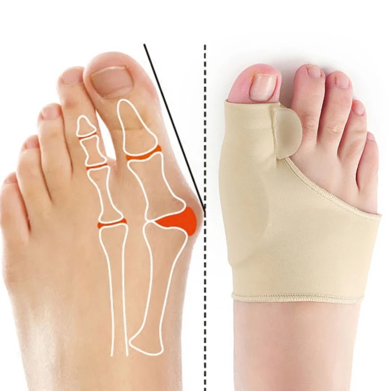 

10-30Pair Bunion Splint Big Toe Straightener Corrector Foot Pain Relief Hallux Valgus Correction Orthosis Pedicure Foot Tools