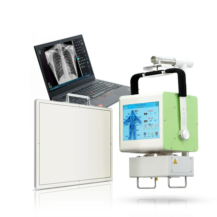 

YSX050-C hospital DR flat panel mobile X Ray 5kw touch screen digital portable X-ray machine