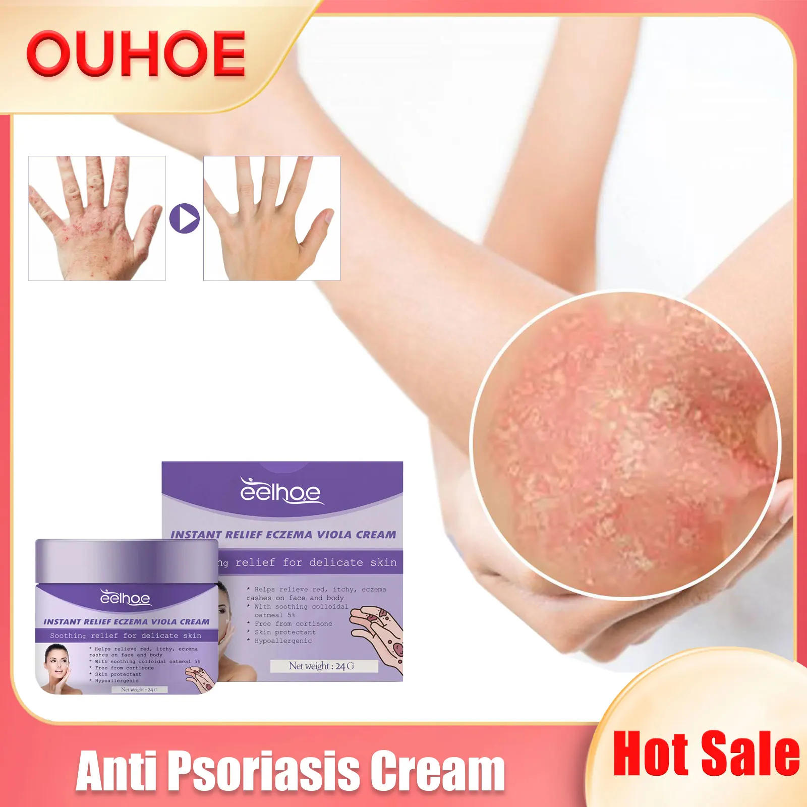 

Anti Eczema Cream Improving Redness Antibacterial Dermatitis Itching Hands Foot Tinea Relief Sooth Psoriasis Treatment Ointment