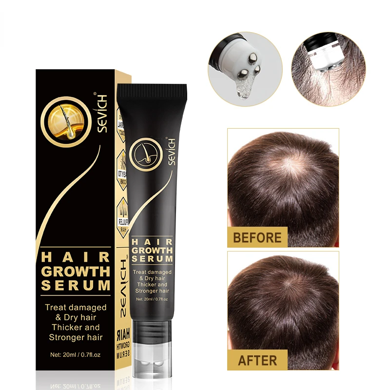 

Sevich Hair Growth Oil Ginger Extract Growing Serum Prevent Hair Loss Care Scalp Massage Roller Treatment Thickener Essence 20ml