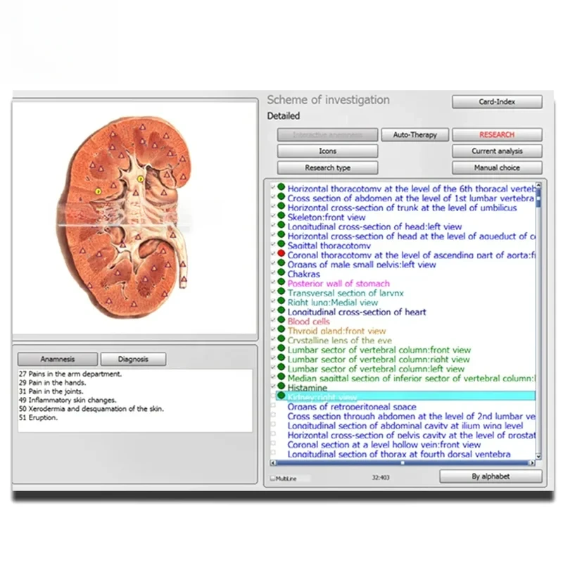Оригинальный русский 3D-анализатор Bioplasm Nls Pro для машины Aura и Chakra