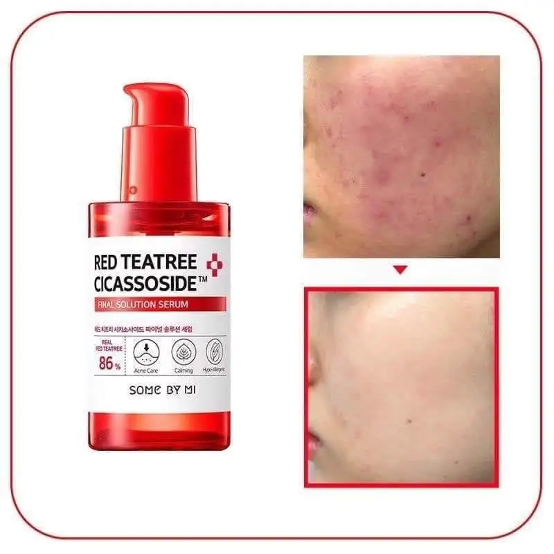 

SOME BY MI Red Teatree Cicassoside Final Solution Serum 50ml Calm Hypersensitive Skin Moisturizing Whitening Anti-Wrinkle