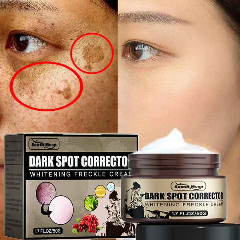 Effective Whitening Freckles Cream Removal Dark Spots Melanin Melasma Brighten Skin Care Anti-Aging Moisturizing Beauty Products
