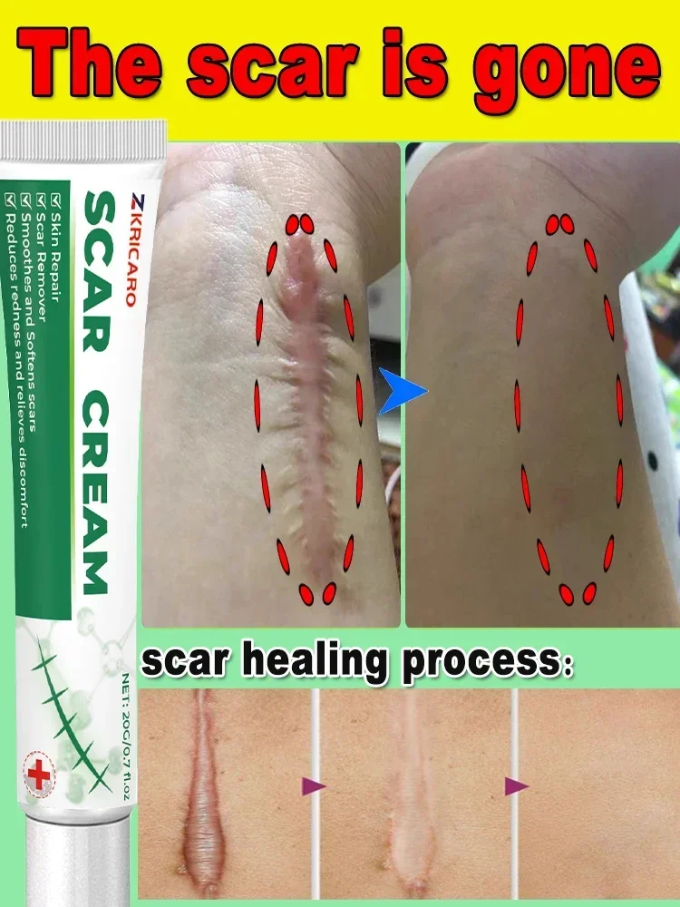 Шрамы самый продаваемый новый продукт постоянный ремонт