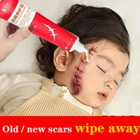 acne surgical scar removal cream pimples stretch marks face gel remove acne smoothening whitening repair body skin care