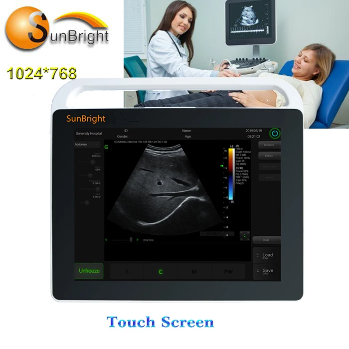 

high quality ultrasound probe convex array lumify Hand-carried Portable touch screen ultrasound potable 2D machine