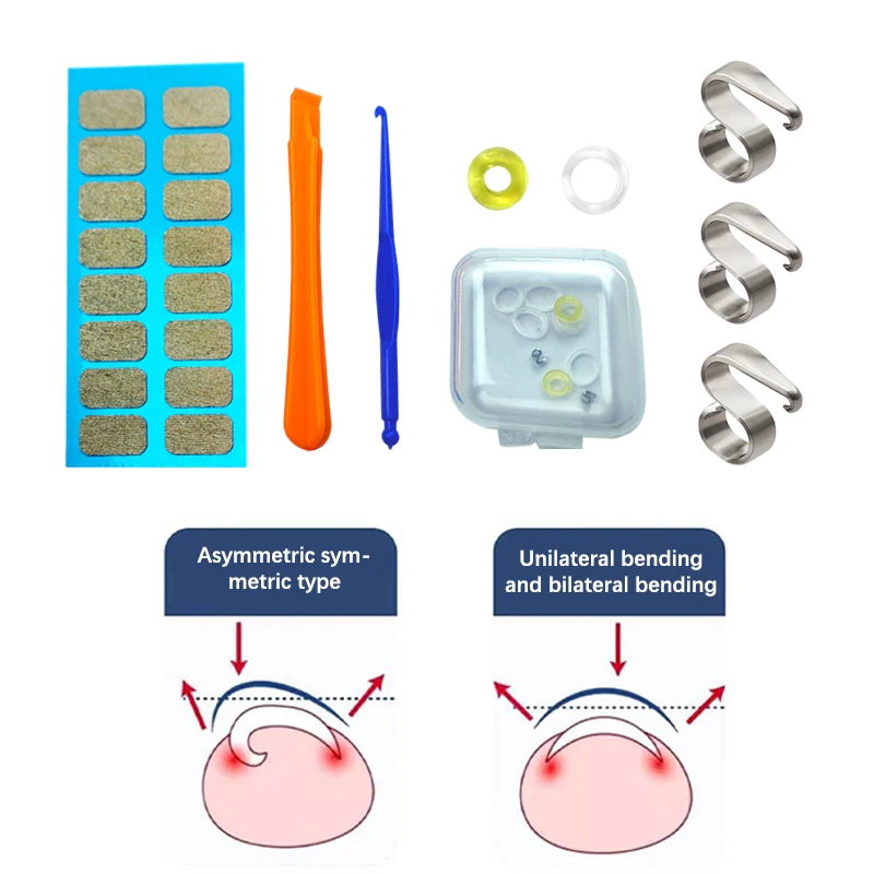 Корректор для вросших ногтей профессиональный инструмент коррекции педикюра