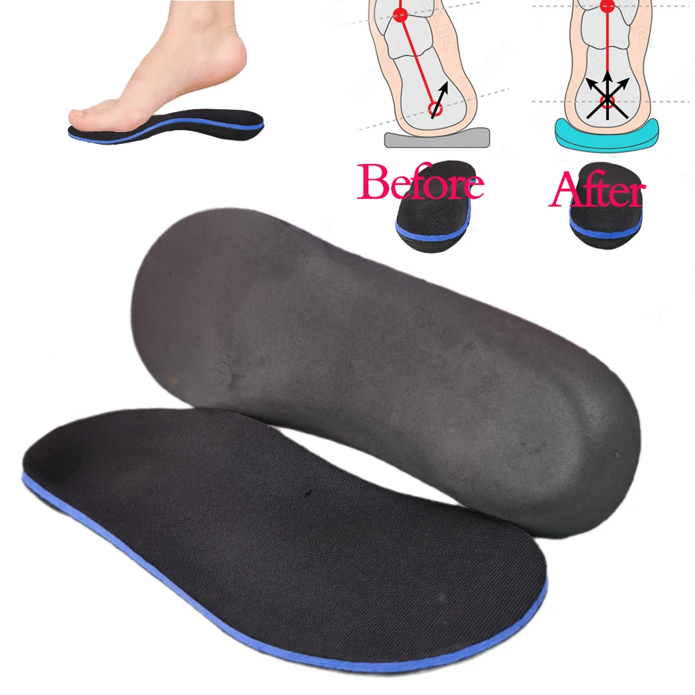 EXPfoot Flat Feet Orthotic Insoles Arch Support Orthopedic Inserts Plantar Fasciitis Feet Pain Pronation for Men and Women