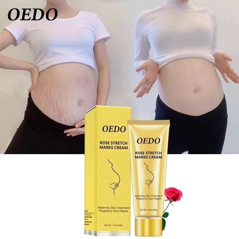 

Rose Remove Stretch Marks Cream Anti Wrinkle Anti Aging Maternity Skin Repair Remove Pregnancy Scars Treatment Body Skin Care