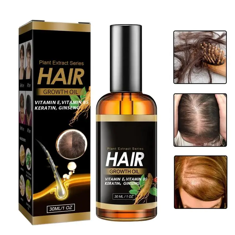 

Эфирные масла для роста волос, увлажняющее эфирное масло для выпадения волос, 1 унция, увлажнение и питание, эссенция для роста волос