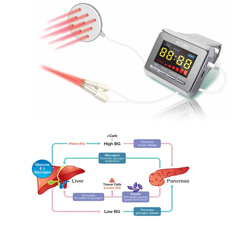 

Electronic acupuncture instrument lllt laser therapy apparatus blood pressure monitor watch low level laser therapy watch