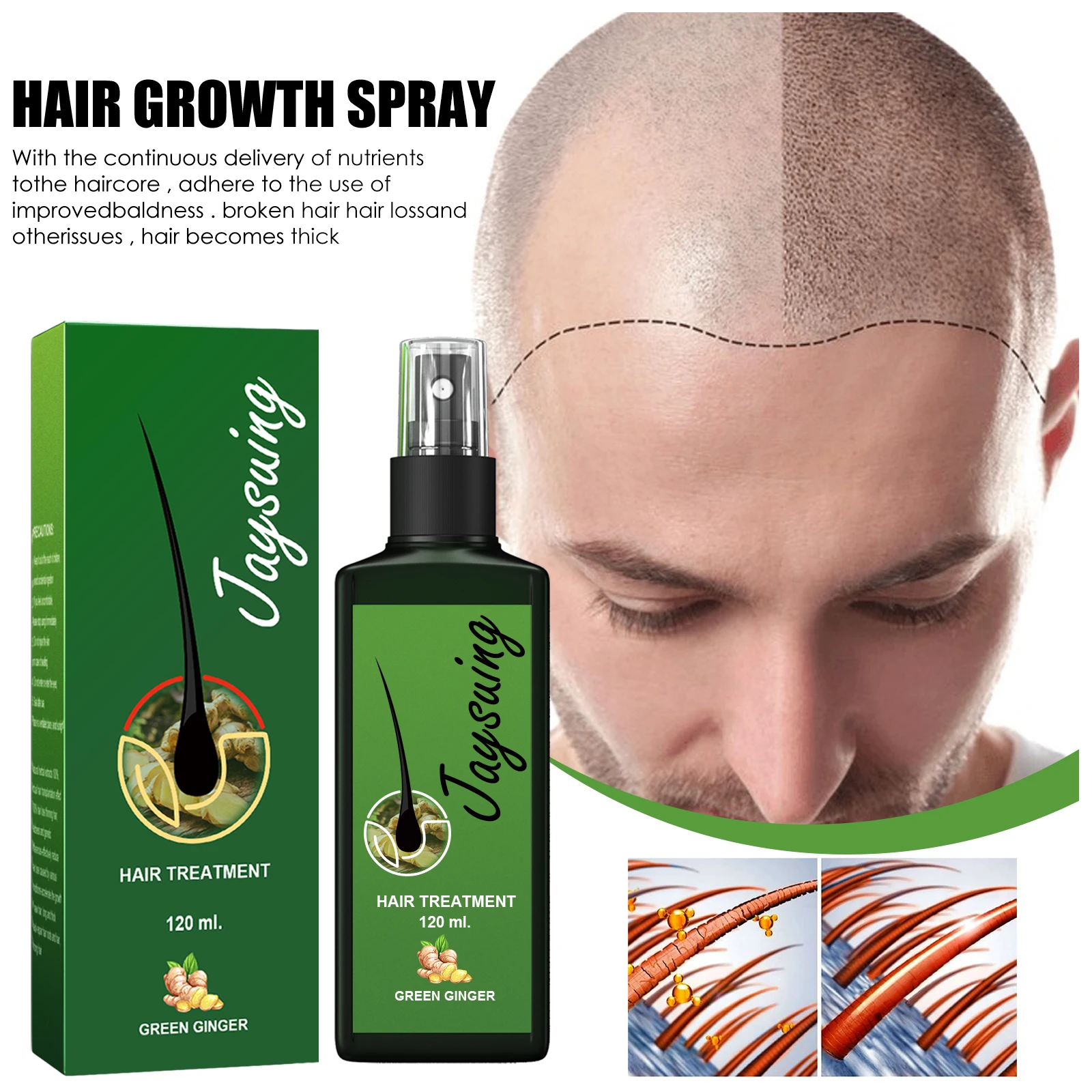 

120ML Germinal Pilatory Natural Extract Baldness Repair Spray NEO Hair Regrowth Lotion Haircare Hair Loss Oil