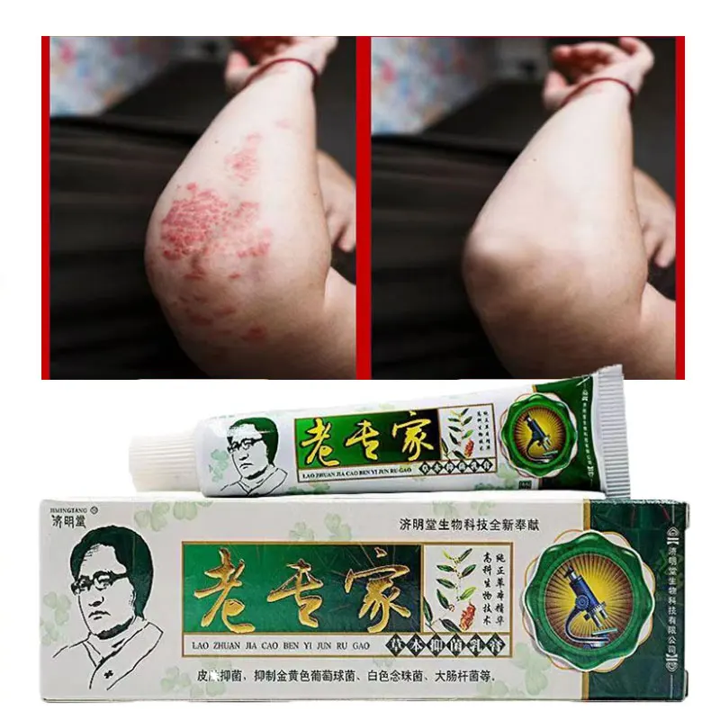 

Мазь при псориазе и дерматите, крем от грибковой инфекции дерматита и экземы (в розничной упаковке)