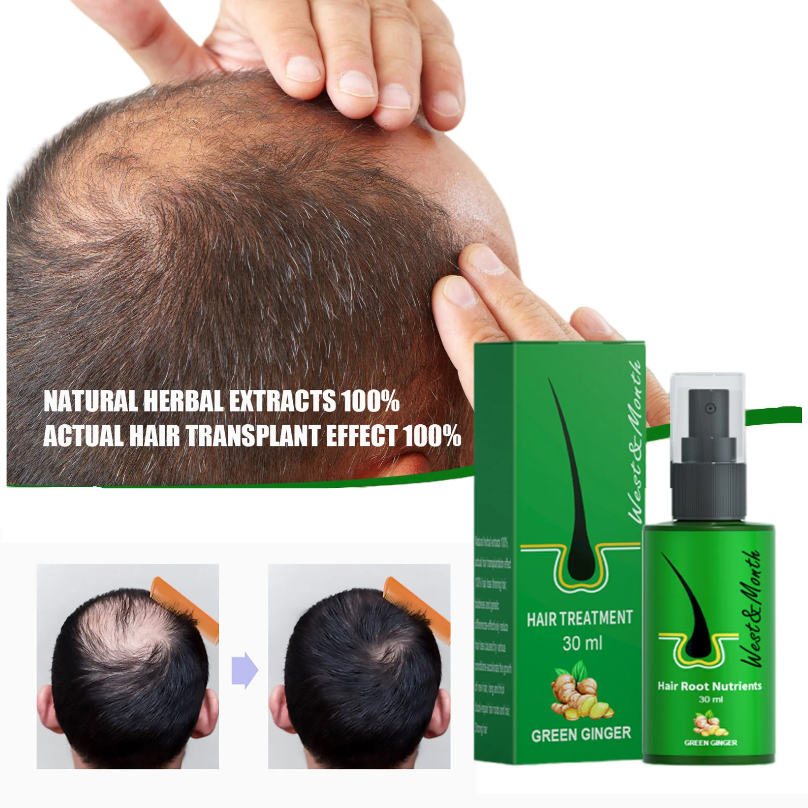 

Ginger Hair Growth Spray Anti Hair Loss Treatment Fast Growing Essential Oil Promote Hair Regrowth Products For Men Women 30ml