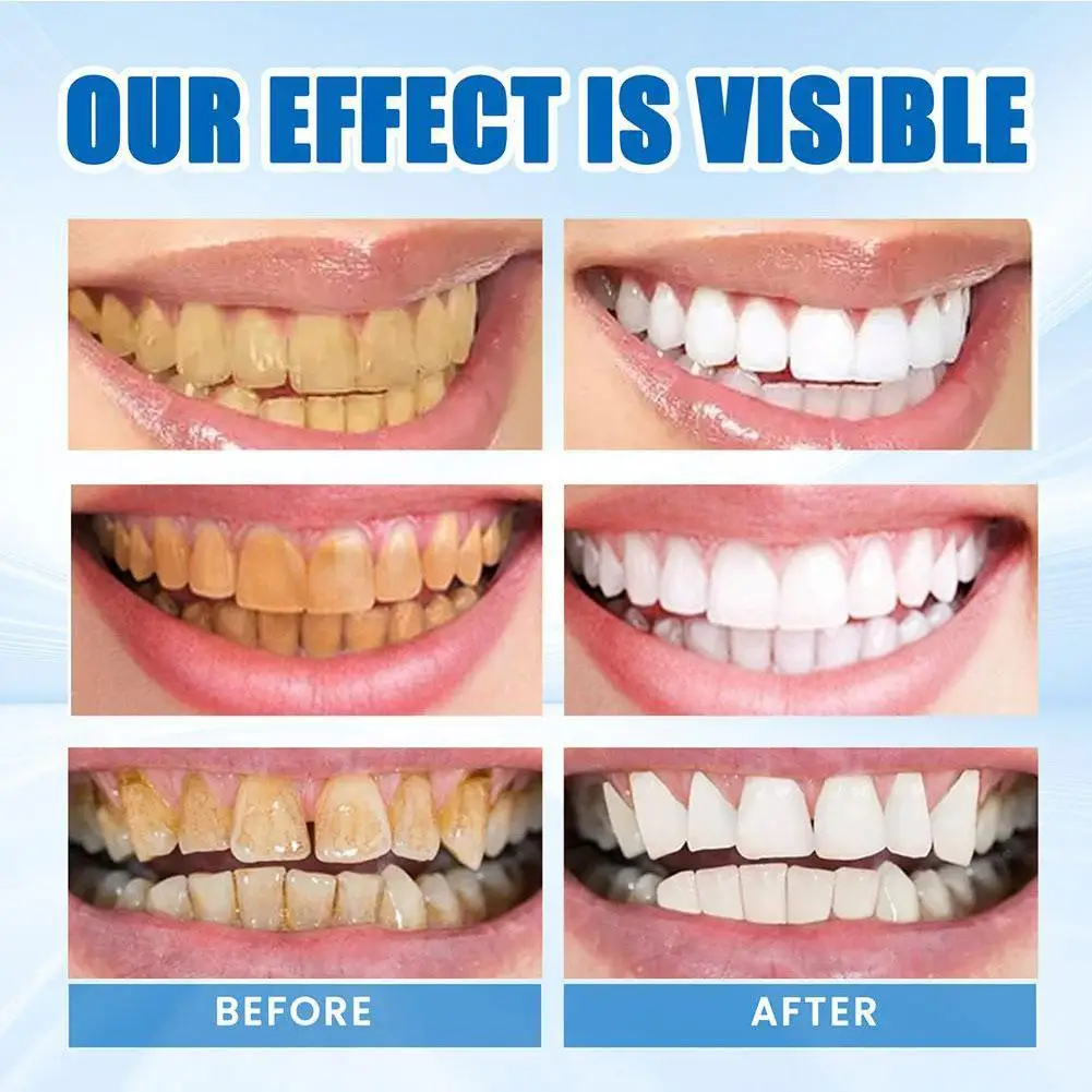 

V34 Fruit Flavored Toothpaste Whitens Teeth Eliminates Yellowness Odor Stains Fluoride Containing Children's Glorysmile Refreshe