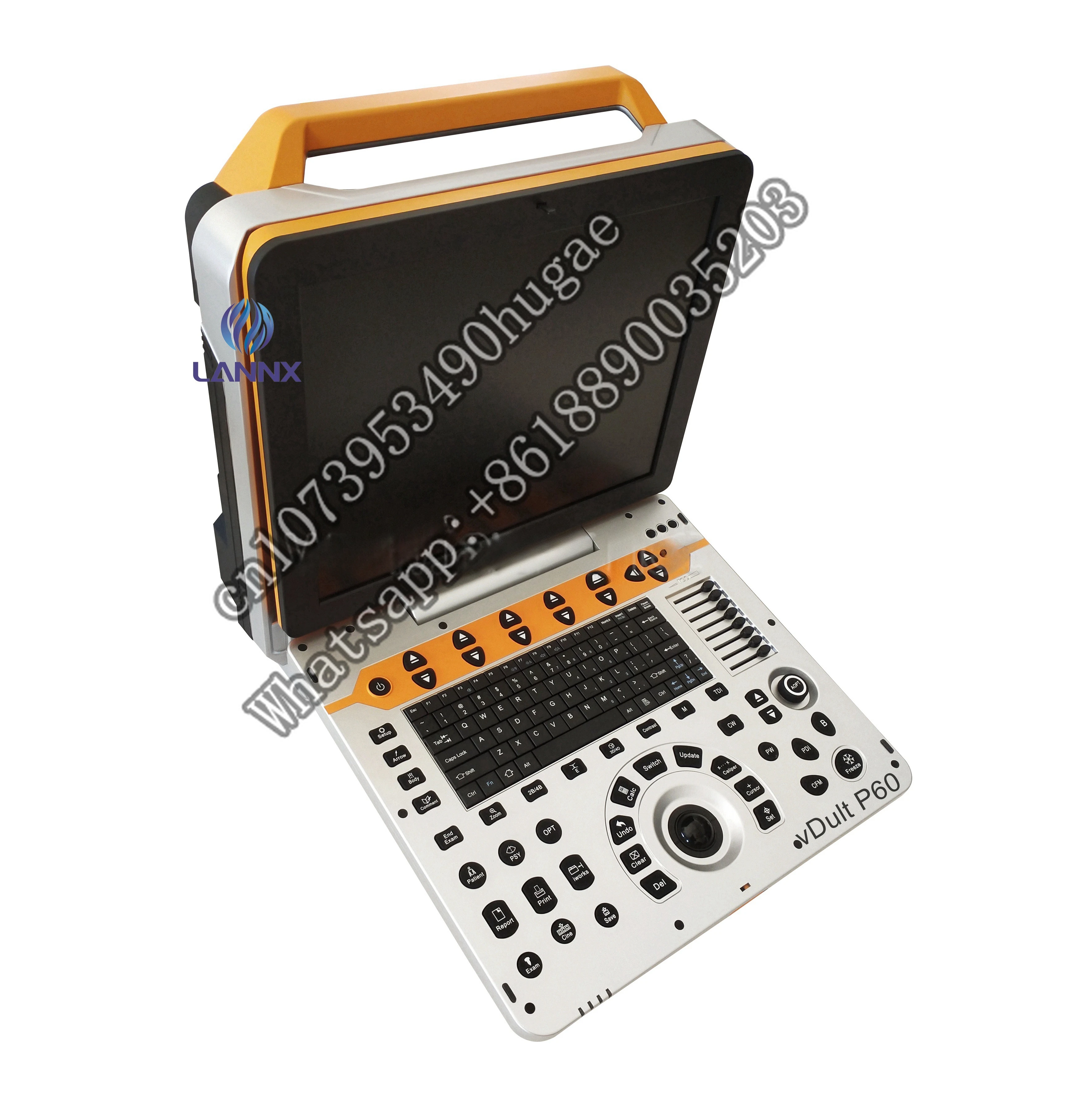 LANNX vDult P60 Цифровой 3D 4D Цветной Допплер