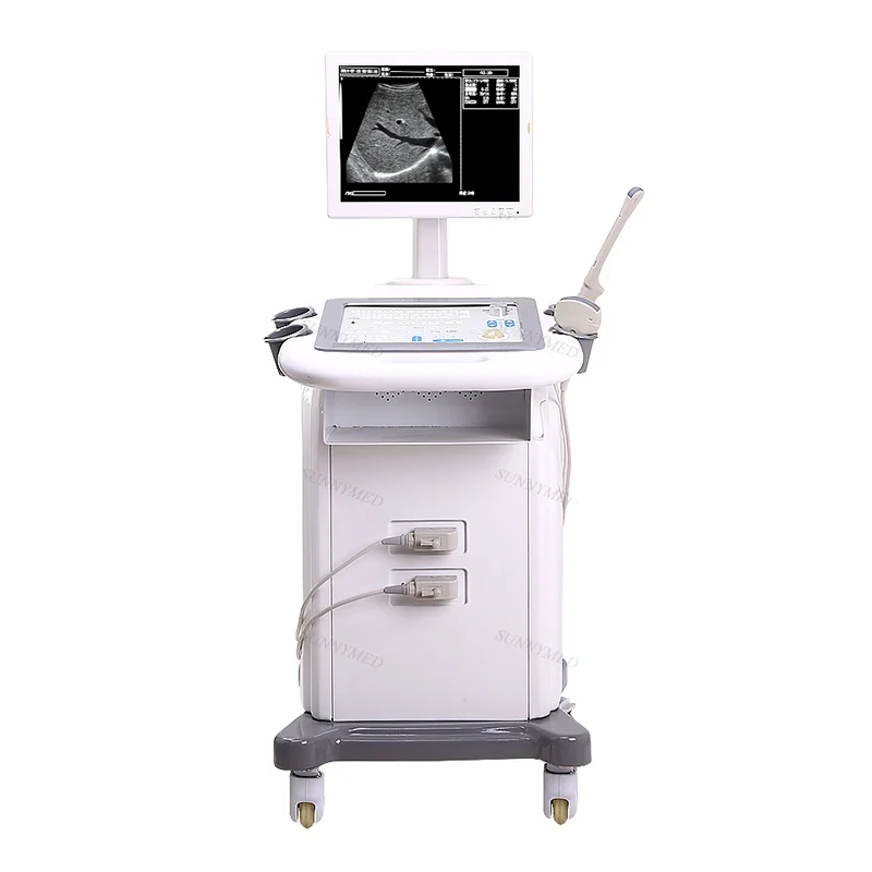 

SY-A019 Hospital Standard Black white Trolley Ultrasound Scanner Price