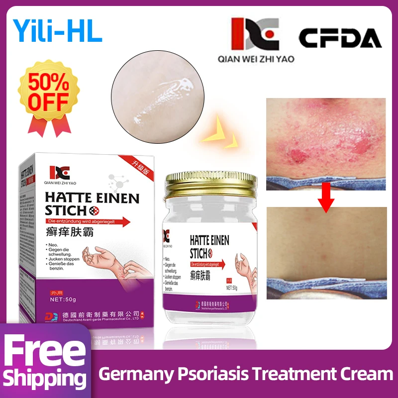 

Psoriasis Treatment Natural Herbal Cream Eczema Pruritus Repair Germany Medicine Dermatitis Fungus Skin Anti-itch Ointment