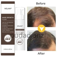 fast hair growth essence natural herbal health treatment hair loss makes hair growth longer and thicker hair care products 30ml