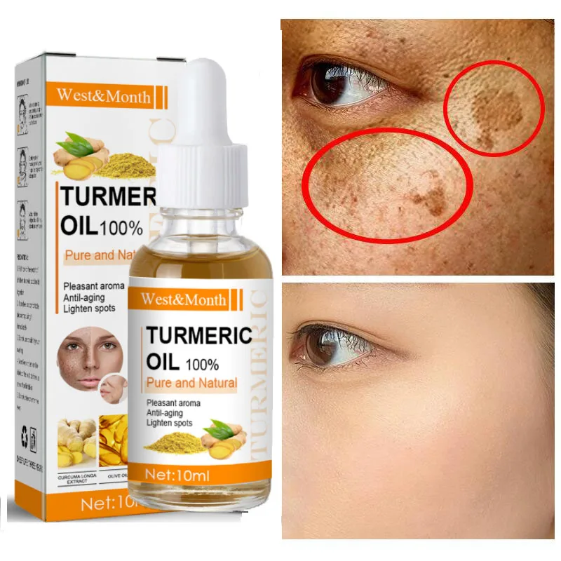 Turmeric Whitening Freckles Serum Removal Melasma Fade Dark Spots Acne Scars Repair Essence Anti Aging Brighten Beauty Skin Care