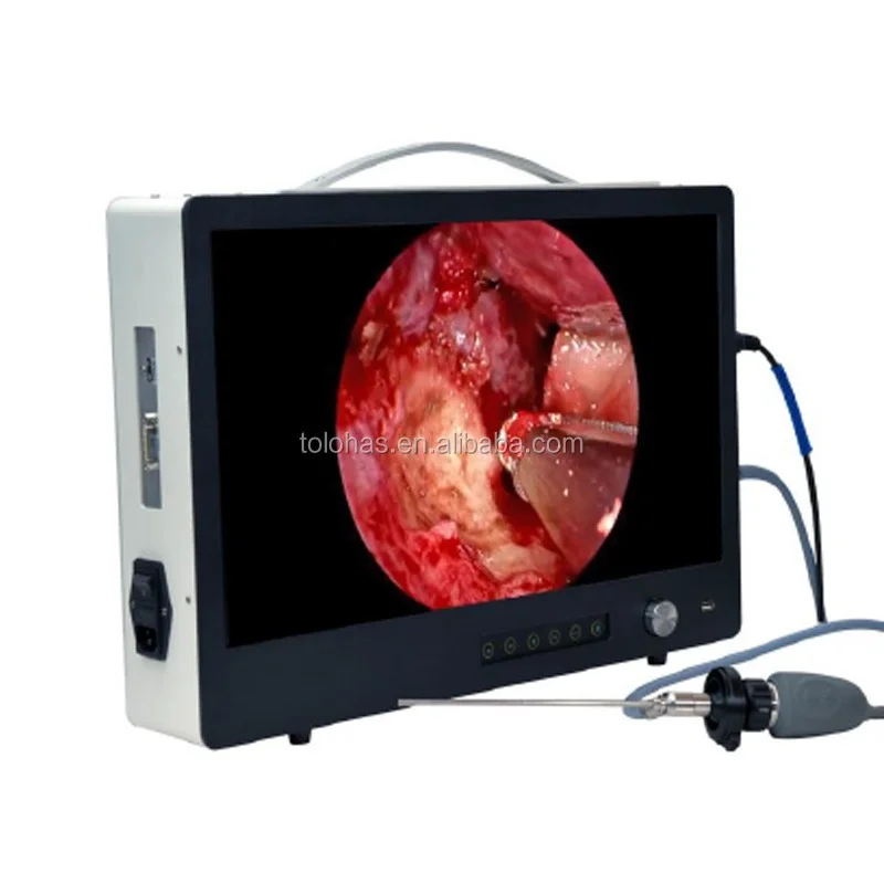 

LHPY9122 ALL-IN-ONE Portable Endoscope System/22 inch HD Screen Laparoscopy/Used for All Rigid Endoscopes