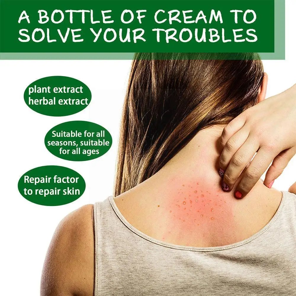 

1PCs Herbal skin itching Antibacterial Cream Psoriasis Treatment Relief Urticaria Cream Rash Desquamation Eczema Anti-itch F8Z1