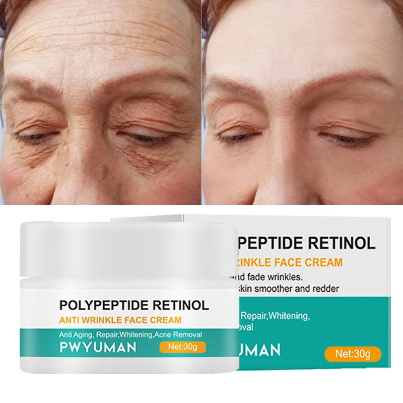 

Retinol Anti-Aging Cream Anti-Wrinkle Facial Gel Lifting Firming Reduce Fine Lines Oil Control Anti-Acne Moisturizing Skin Care
