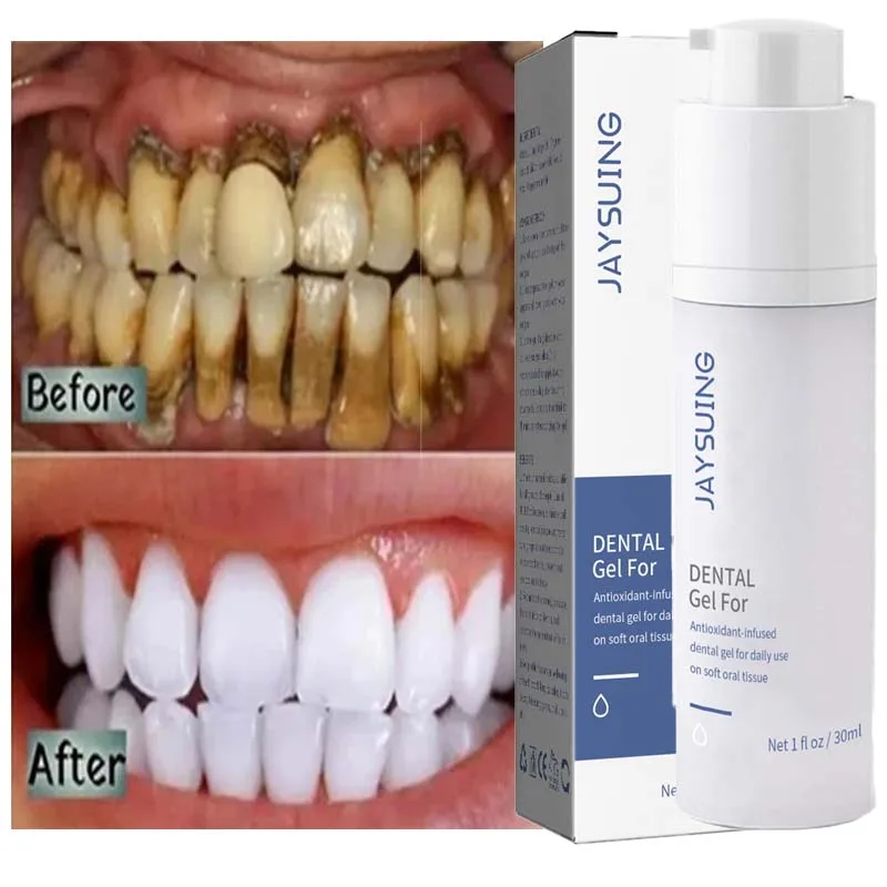 

Teeth Whitening Gel Essence Removes Stains Plaque Foam Toothpaste Odor Removal Fresh Breath Deep Cleaning Tooth Care Products