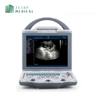 new veterinary b mode portable ultrasound scanner with micro probe