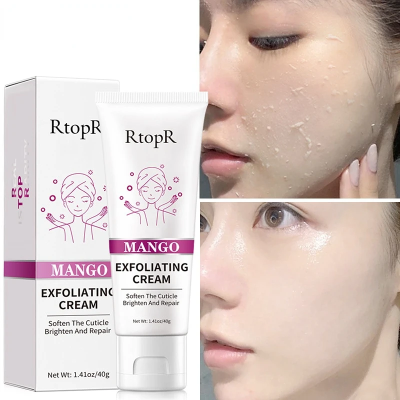 

RtopR Mango Blackhead Remover Nose Mask Acne Treatment Oil Control Shrink Pores Deep Cleansing Black Face Mask T Zone Skin Care