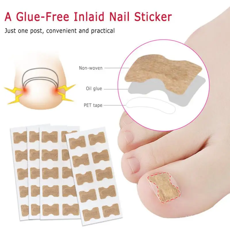 

10 Pcs Ingegroeide Pads Nagel Groove Orthopedische Pads Nail Correctie Apparaten Correctie Behandelingen StickerVoetverzorging