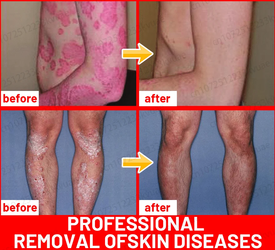 Быстро очищает кожу и восстанавливает ее здоровый гладкий