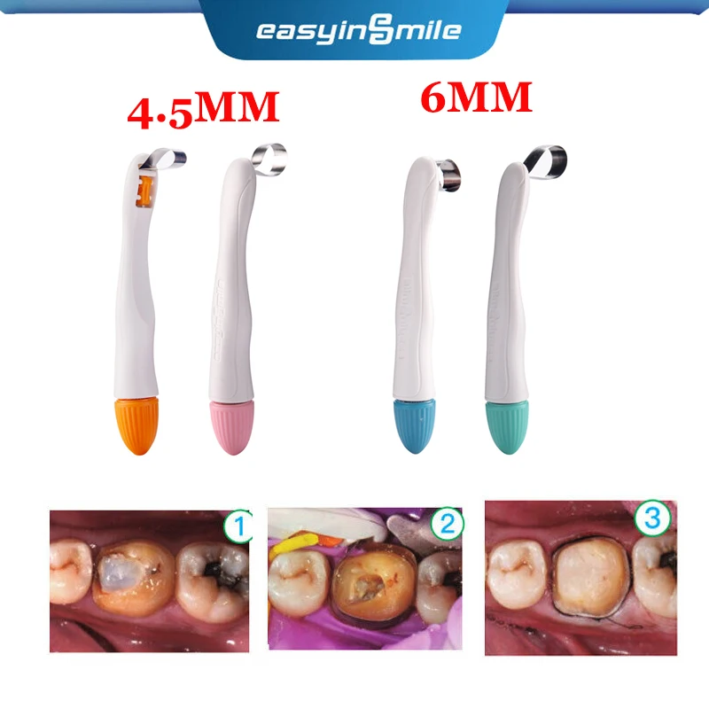10 шт. стоматологические Pro Matrix Bands Easyinsmile предварительно сформированные