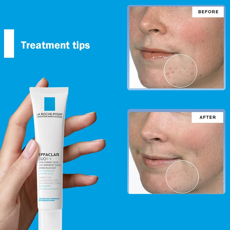 

La Roche Posay Effaclar DUO+/K+ Whitening Acne Removal Cream Treatment For Acne Blemishes Pimples Blackheads And Whiteheads
