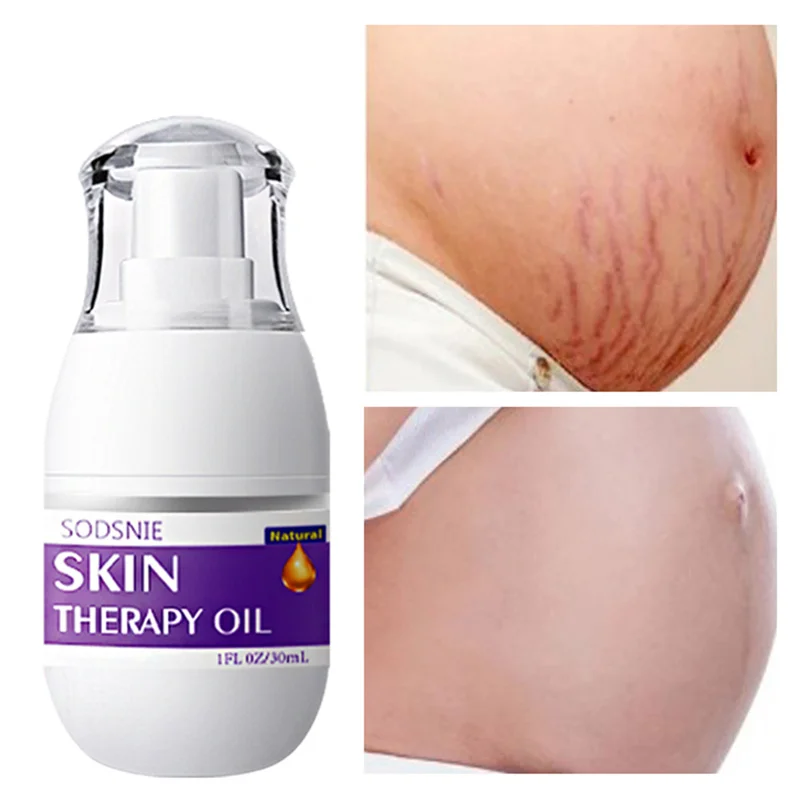 

Natural Skin Therapy Oil Eliminates Stretch Marks And Scars Repairs Aging Damaged Skin Whitening Moisturizing Body Skin Care