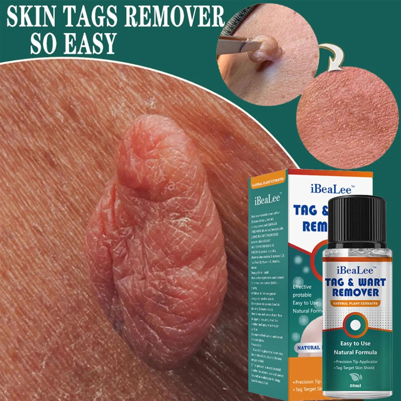 

Skin Tags Remover Painless Mole Skin Dark Spot Warts Face Remover Essential Tag Treatment Serum Oil Cream Freckle Removal W S4T5
