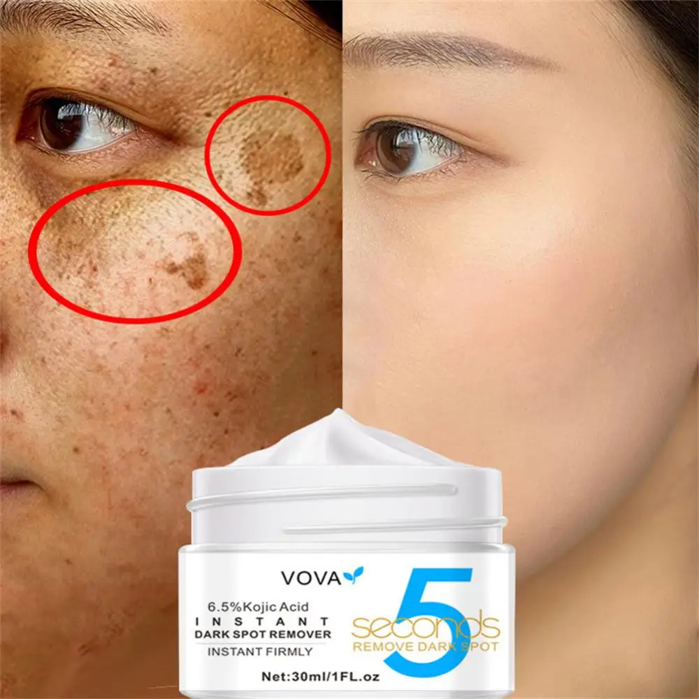 

VOVA Kojic Acid Dark Spot Removal Cream Face Cream Skin Anti-Wrinkle Moisturizer Brighten Skin Fade Spots Skin Care 30ml