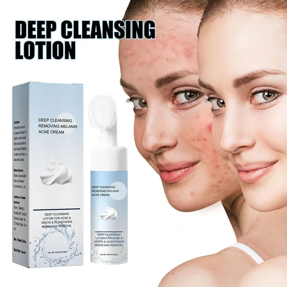 

Deep Cleansing Lotion For Acne Spot Acanthosis Nigricans Built-In Silicone Brush Whitening Pimple Spots Blackhead Removal