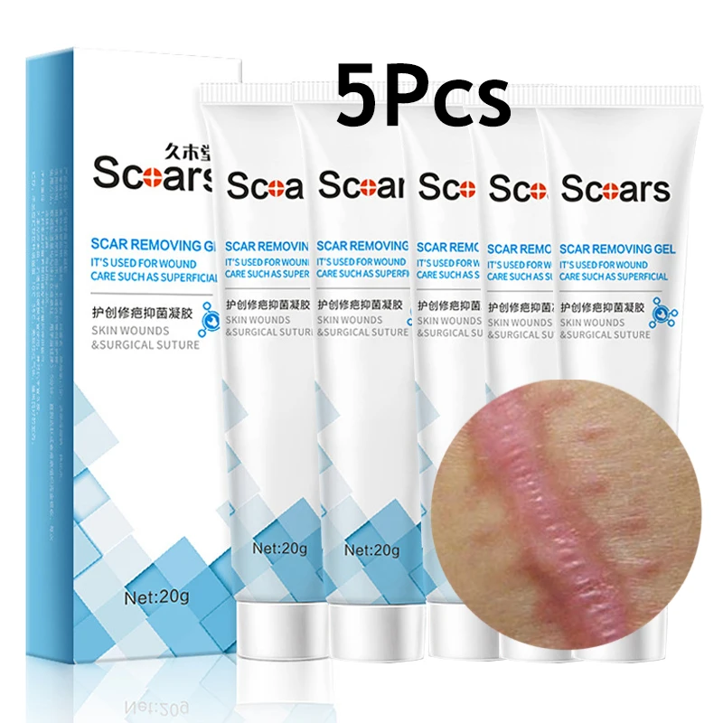 5Pcs Scar Removal Cream Stretch Marks Repair Gel Acne Spots Burn Surgical Old New Scars Remover Treatment Whitening Skin Care