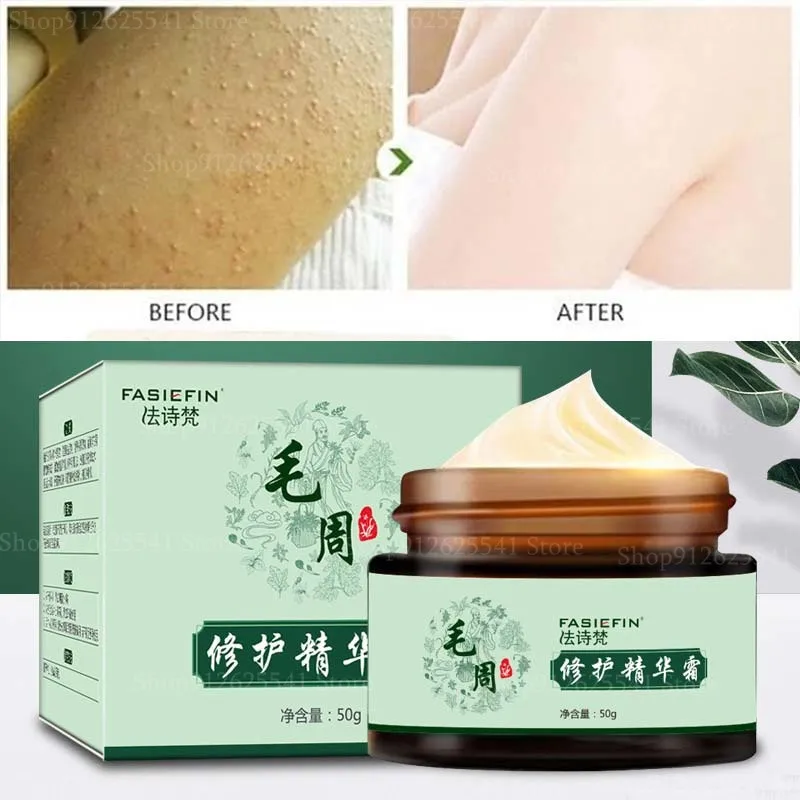 50 г крем для волосяного фолликула и кератоза восстанавливает кожу