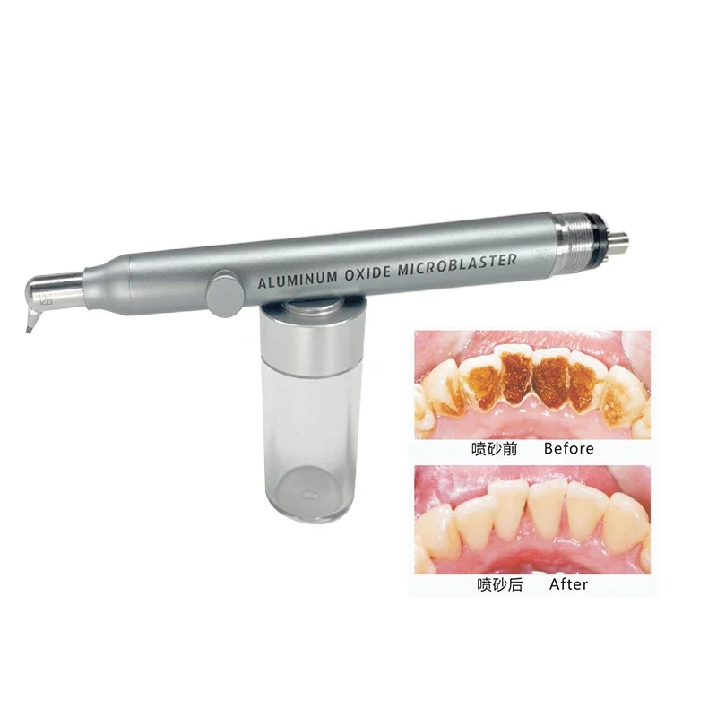 LK-L13 Стоматологические микропетлители Prophy Jet Air Flow Полировальная машина