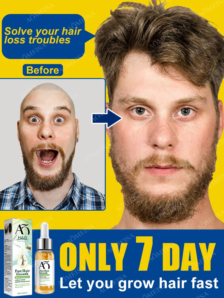 

Hair Growth Oil Fast Hair Growth Effective Baldness Repair Hereditary Hair Loss Postpartum Hair Loss Seborrheic Hair Loss