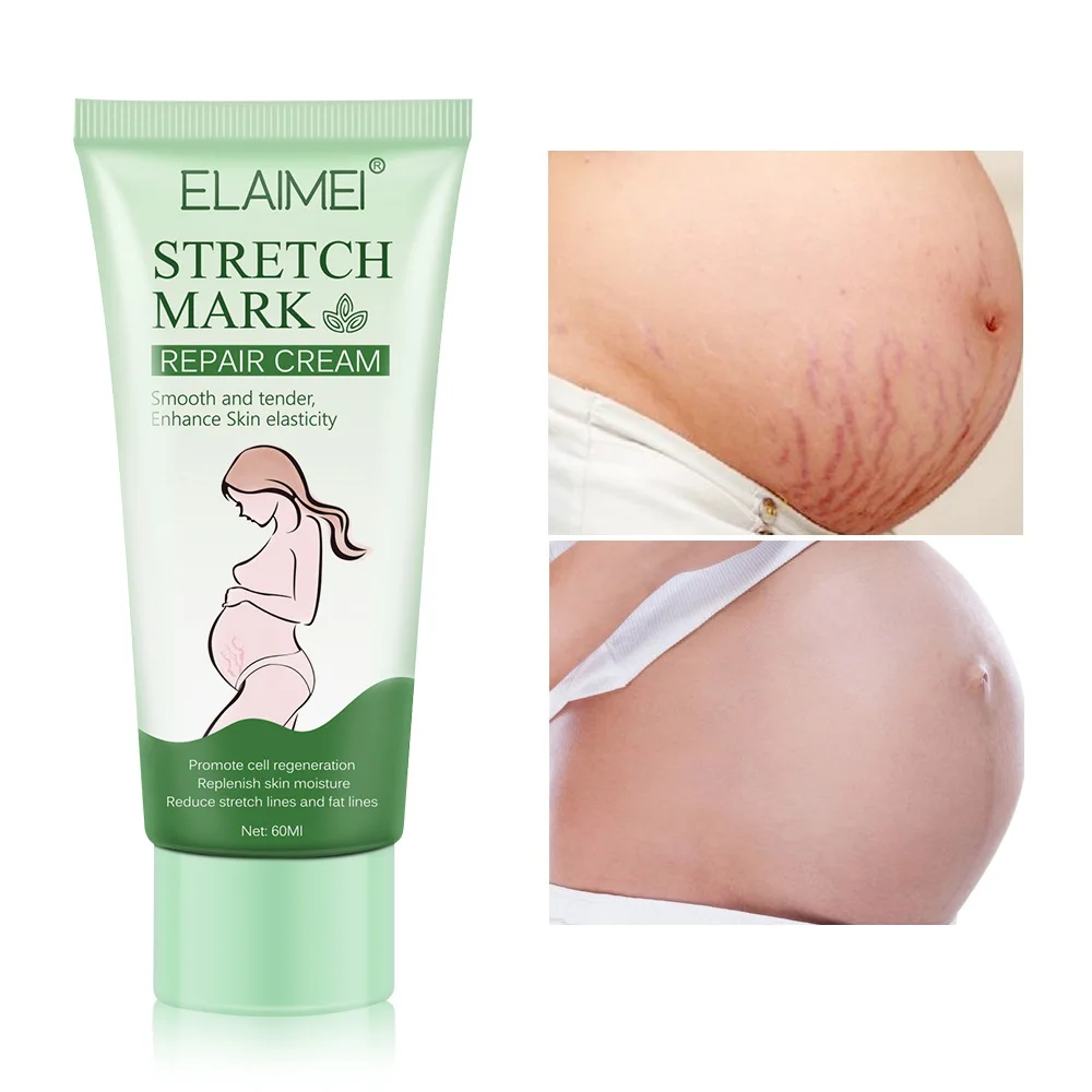 

Stretch Mark Repair Cream Removes Postpartum Scar Treatment Lighten Pregnancy Surgery Burn Scars Nourish Enhance Skin Elasticity