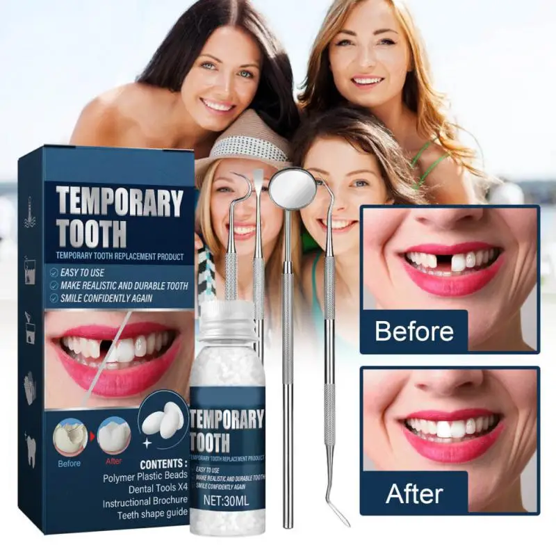 

Safe Missing Tooth Convenient Tooth Repair Kit Affordable Durable Filling Material Temporary Tooth Repair Kit Quick Fix