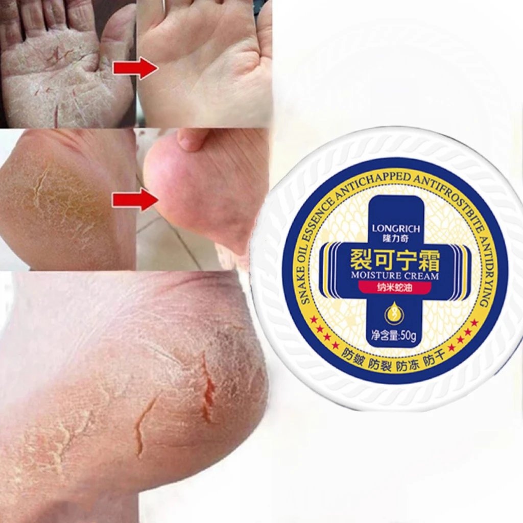 

Крем для ног 50 г против трещин, маска для сухости ног, восстанавливающий крем для пятки с трещинами, для рук, для удаления мозолей и омертвевш...