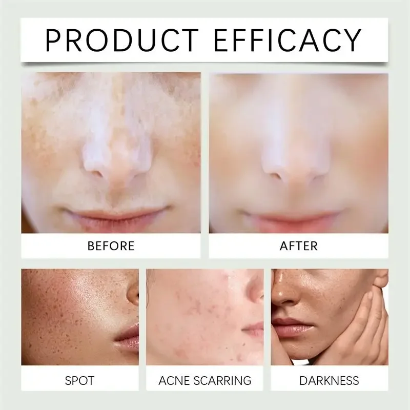 Увлажняющий увлажняющий крем для лица корректор темных точек