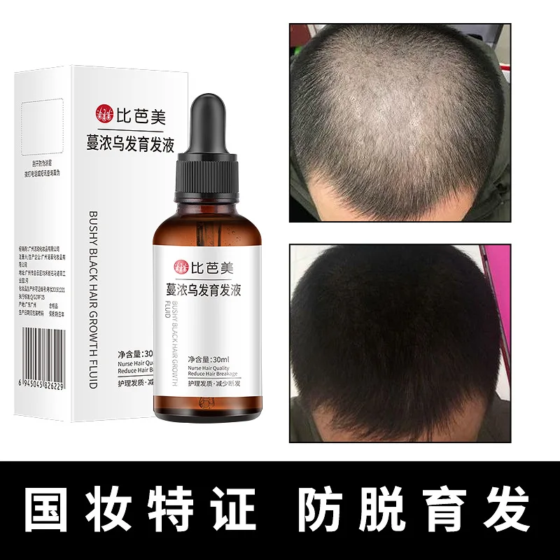 30ml Black Hair Growth Liquid Balancing Grease Restore Hair Root Activity and Strengthen Hair Core Hair Care Free Shipping