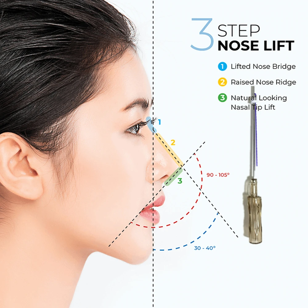 

2022 Korea Original Hilos Tensores CE Nose Blunt Cannula 19G38MM Lift PDO PLLA for Bulbous Nose Correction