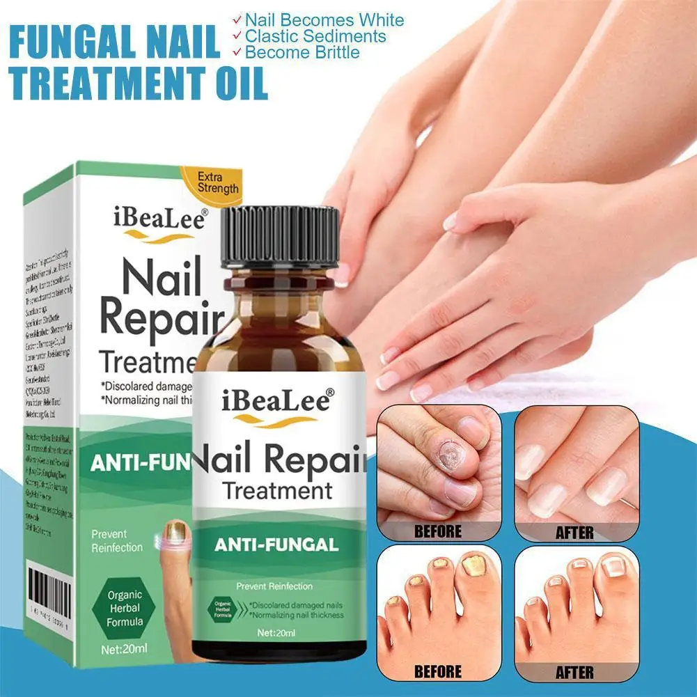 

Nail Fungal Treatment Feet Care Essence Nails Foot Repair Toe Nail Fungus Removal Oils Anti Infection Paronychia Onychomycosis